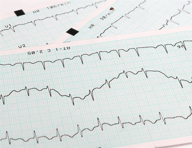 The new NSF award supports arrhythmia in sick hearts