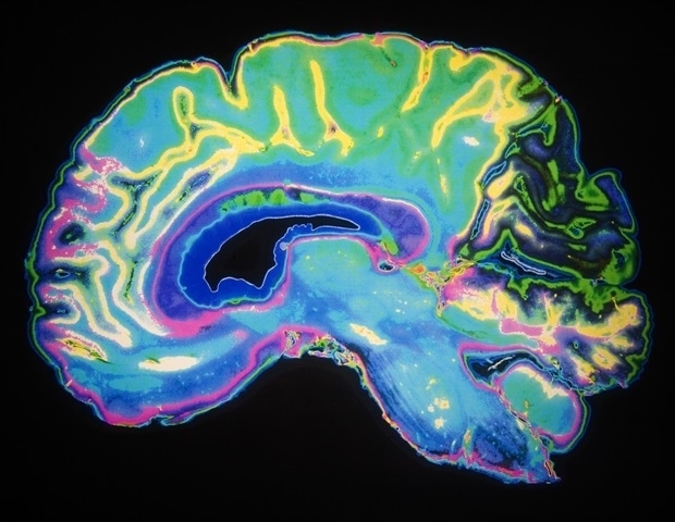 Mental diet associated with a lower risk of dementia in various populations