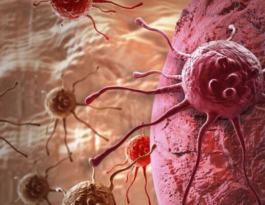 Self -control tests can be a solution to increase access to screening in the field of cervical cancer