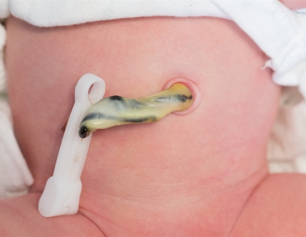 Umbilical cord proteins help detect early sepsis in premature babies