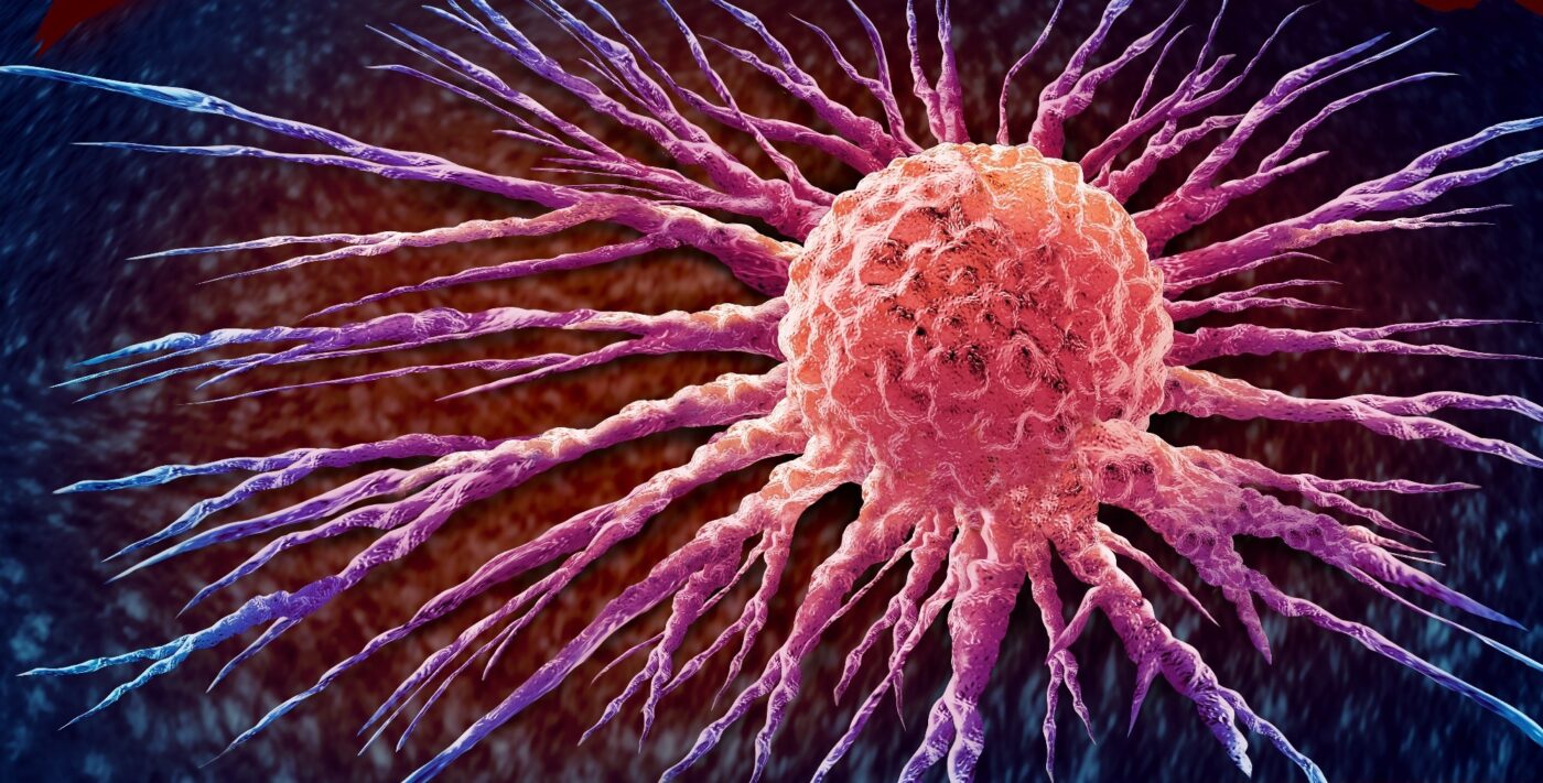 Blocking a single gene interferes with the metabolism of vitamin D and cancer trails in the new cell examination