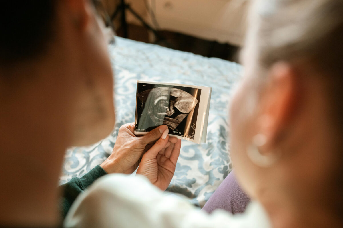 Treatment of New Hodgkina lymphoma increases fertility without sacrificing survival