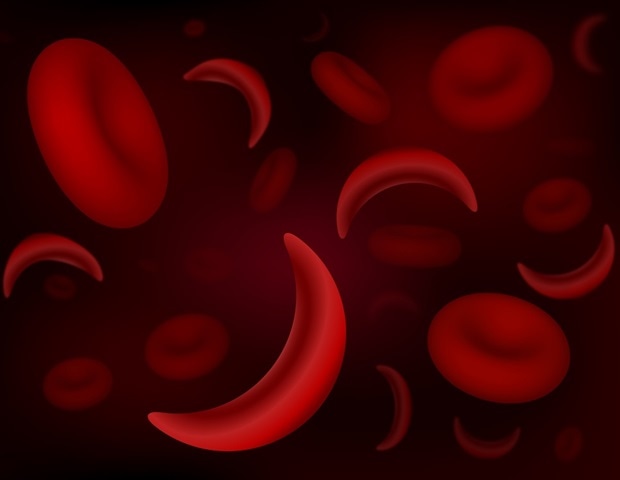 Luki in the field of dental care affect children with sickle diseases in Michigan