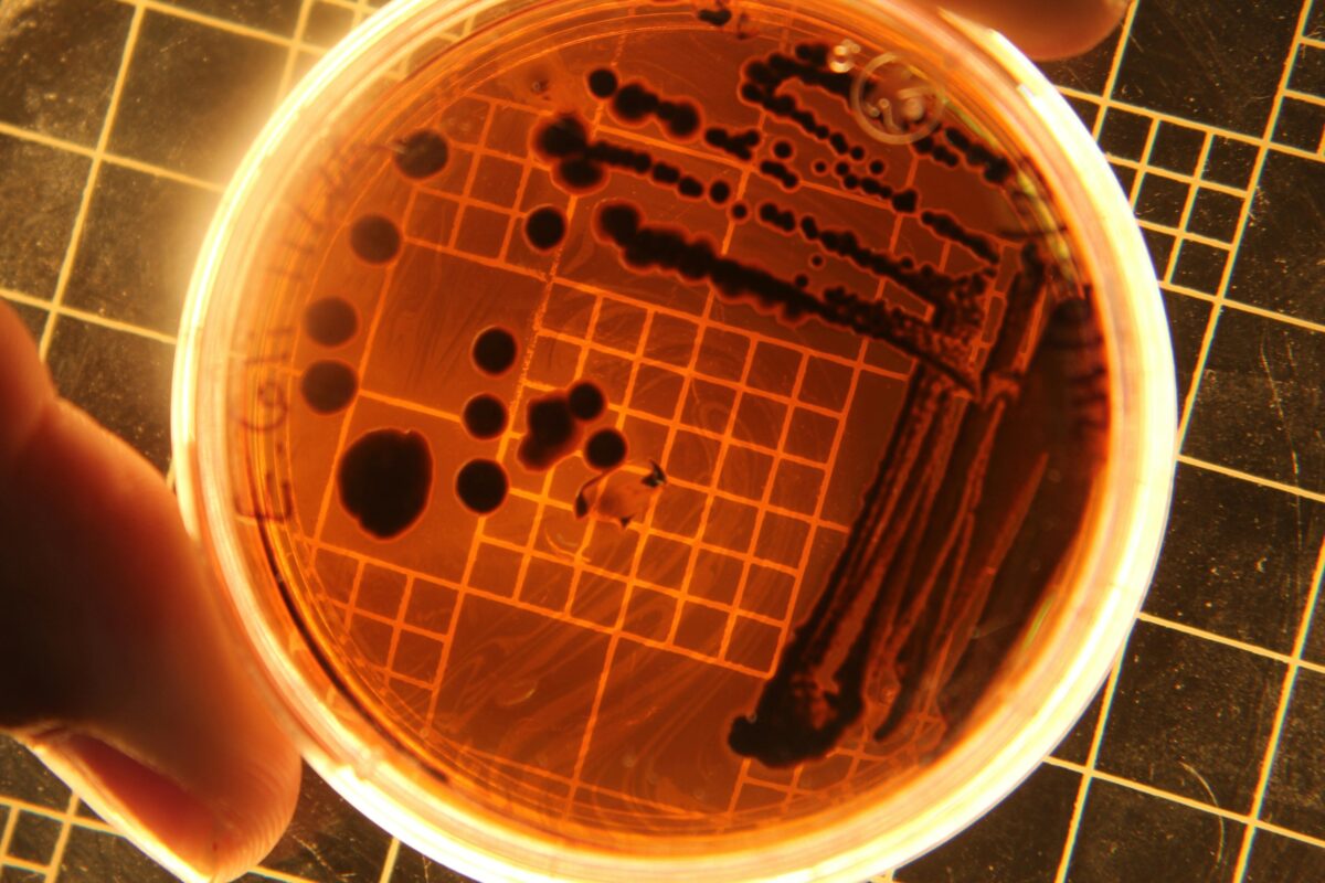 Salmonella oftbreak Surchens 16, CDC warns about more cases