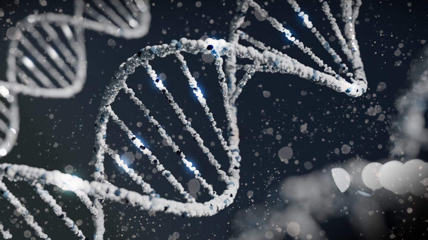 The first successful gene therapy for Huntington’s disease slows down the progression of the disease by 75%